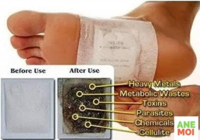 MiniMarvels™ Natural Detox Foot Patches – Stress Relief & Body Cleansing Pads (Set of 10)